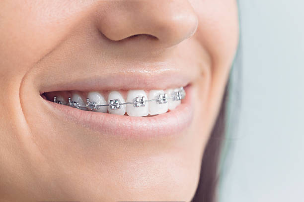 Best Traditional Braces  in Waseca, MN